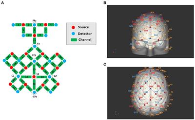 Cortical activation and functional connectivity during locomotion tasks in Parkinson’s disease with freezing of gait